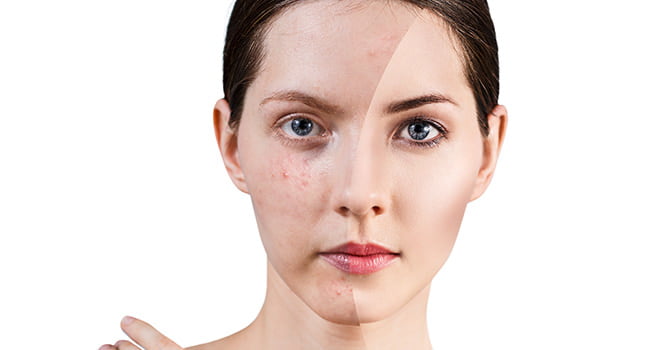 Vrouw Voor En Na Littekens