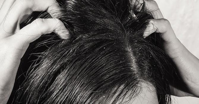 Arganolie En De Behandeling Van Psoriasis