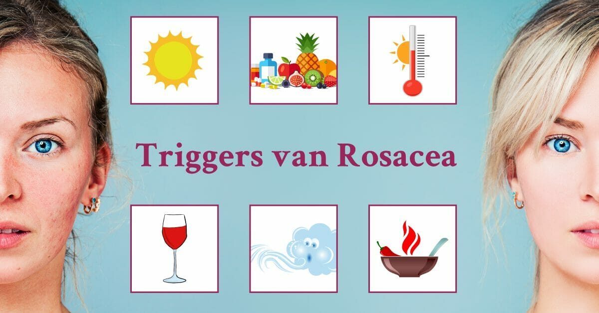 Blonde vrouw Rosacea triggers wijn kou hitte voedsel zon