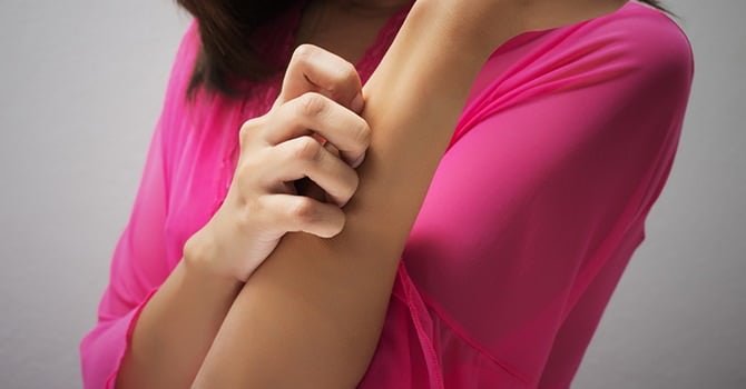 De Jeukende Waarheid van Eczeem