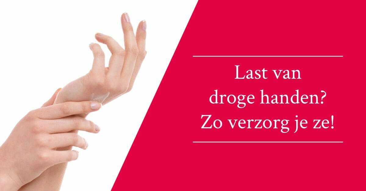 Droge handen verzorging vrouwenhanden vrouw