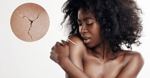 Een Droge Huid Aanpakken Met Arganolie