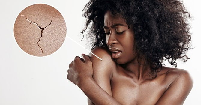 Een Droge Huid Aanpakken Met Arganolie