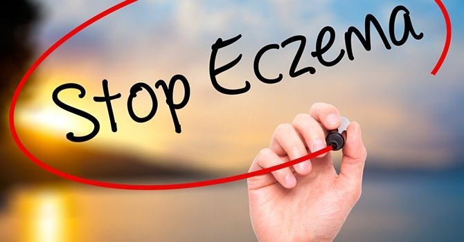 Hoe om te Gaan met Eczeem
