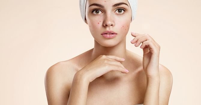 Huidvlekken Behandel met Vitamine E en:of C