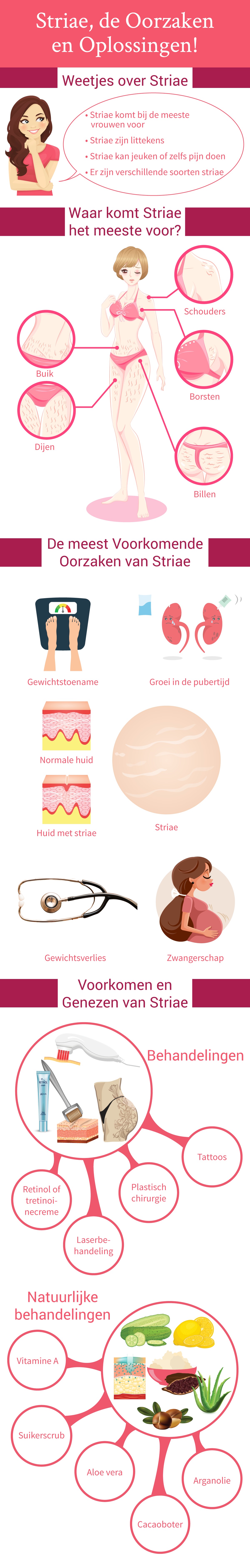 Infographic Striae