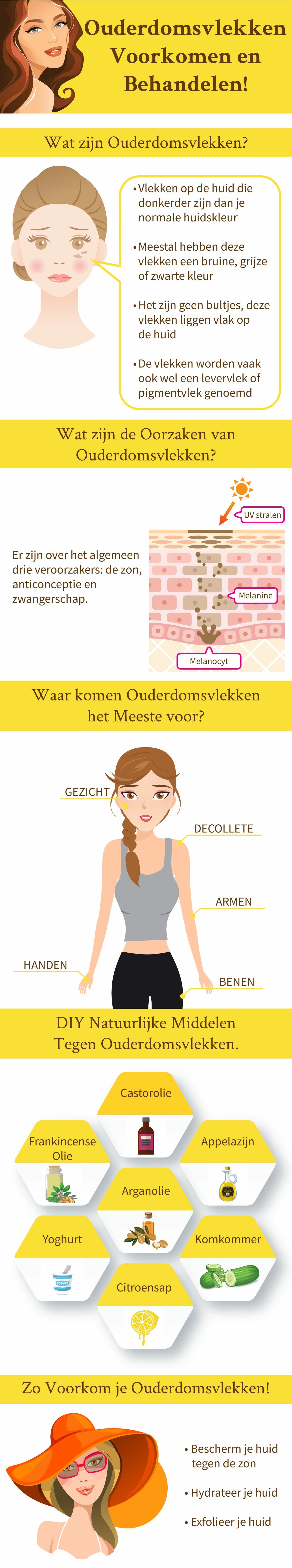 Ouderdomsvlekken in Beeld Infographic.