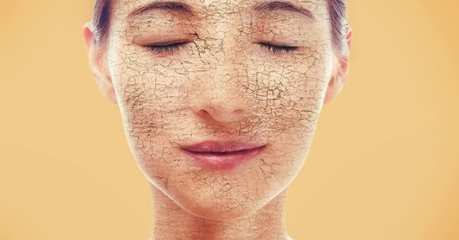 Je Droge Huid Snel Kwijtraken? Volg deze 3 Tips Op!