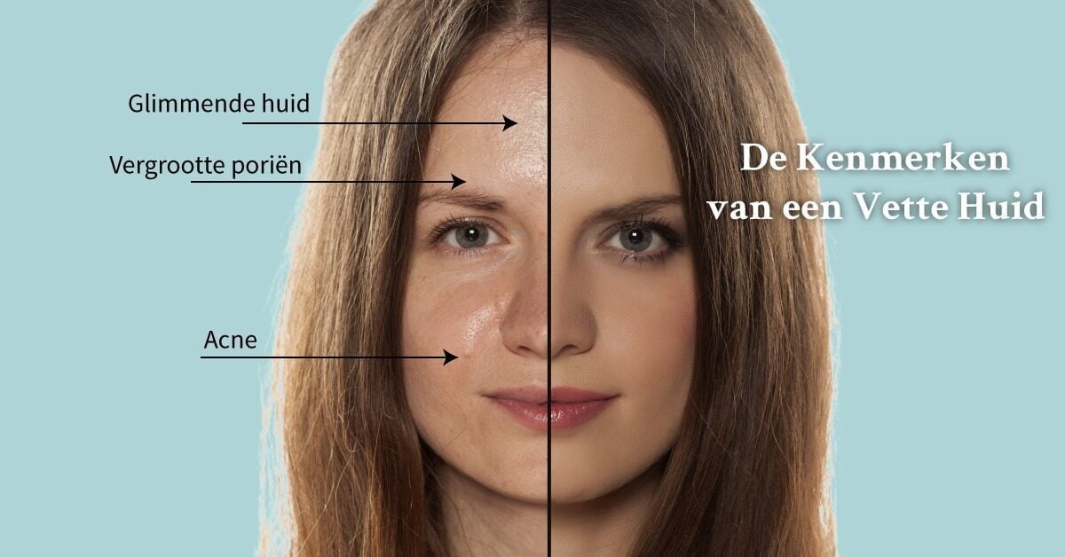 Kenmerken vette huid gezicht half vrouw