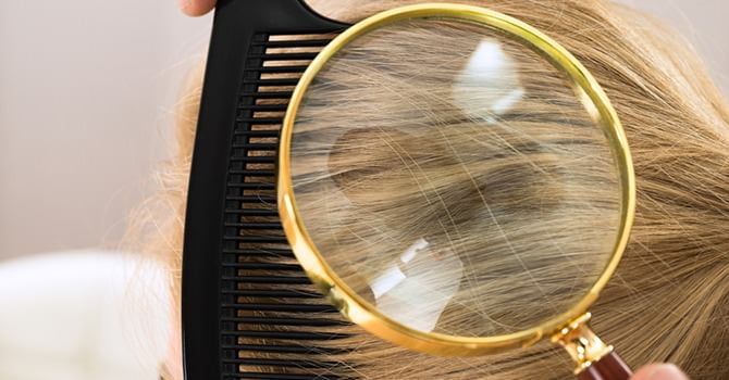 Kom Meer te Weten over de Oorzaken van Psoriasis!