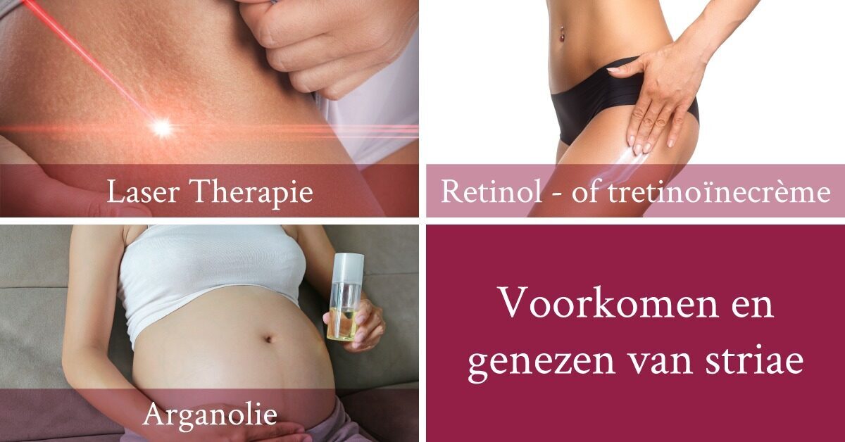 Laser creme arganolie striae benen buik zwanger