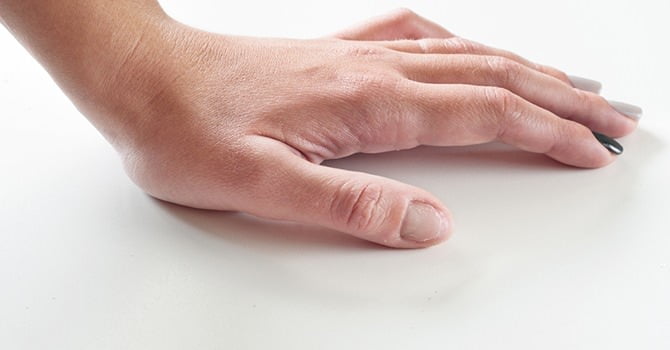 Nagellak trauma, Broze Nagels?