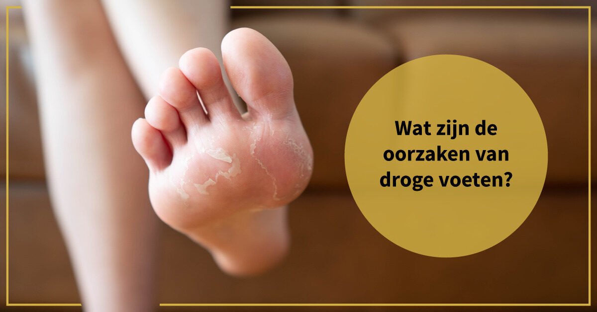 droge voet onderkant tenen