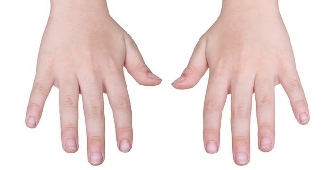Ontdek de Tekenen van de Nagels die Wijzen op een Voedingstekort
