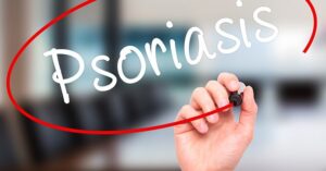 Stop Psoriasis