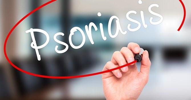 Tekenen en Symptomen van Psoriasis