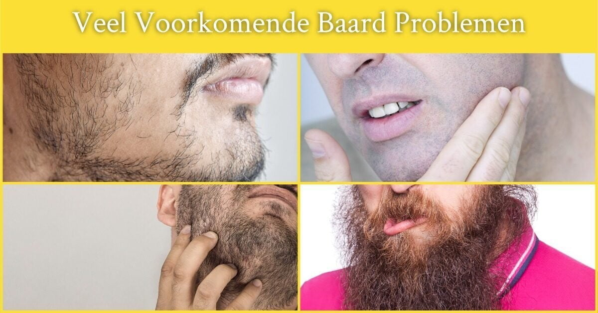 Verschillende Soorten Baarden Baardproblemen