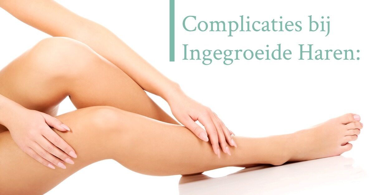 Verzorgde nagels en benen
