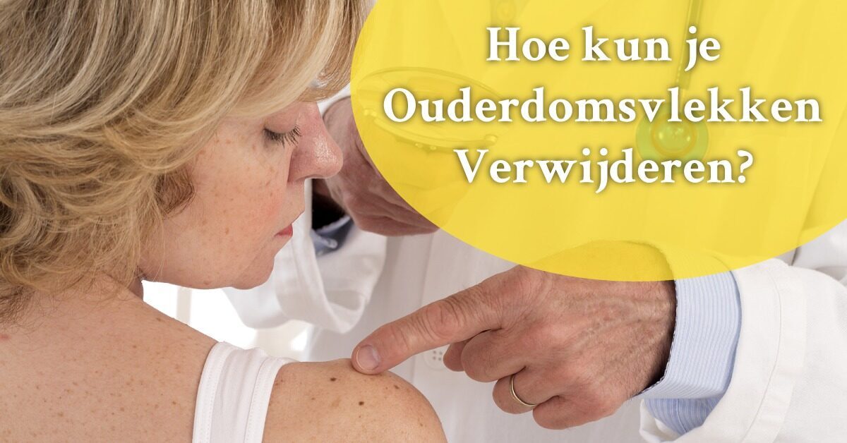 Vrouw dokter ouderdomsvlekken schouder