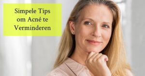 Vrouw hand onder kin