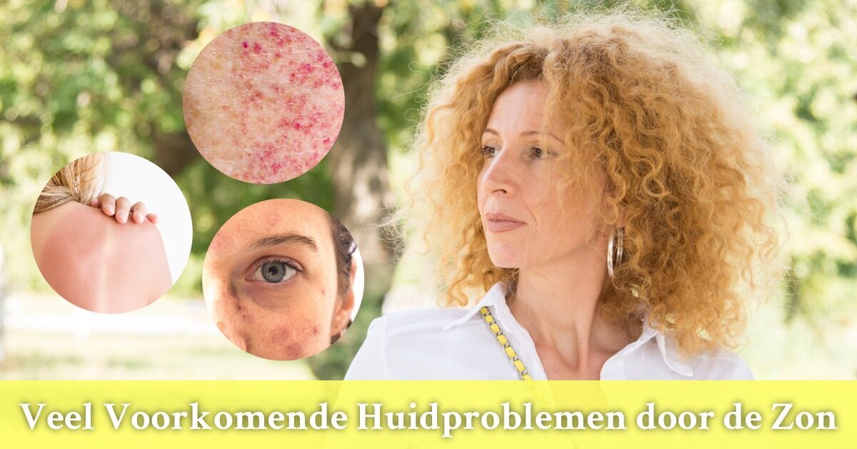 Vrouw huidproblemen