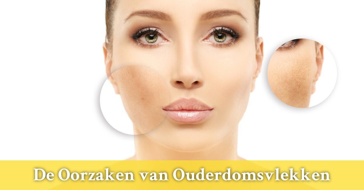 Vrouw ouderdomsvlekken wang