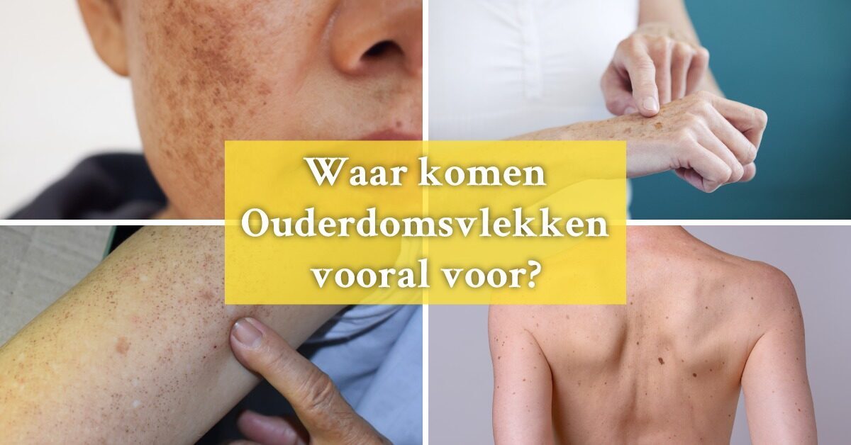 Wang rug hand arm ouderdomsvlekken