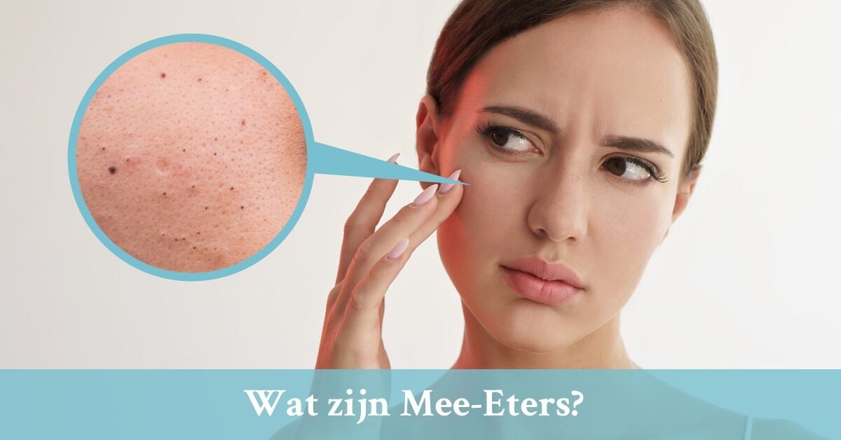 Wat zijn Mee-Eters?