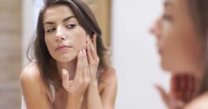 acne vrij