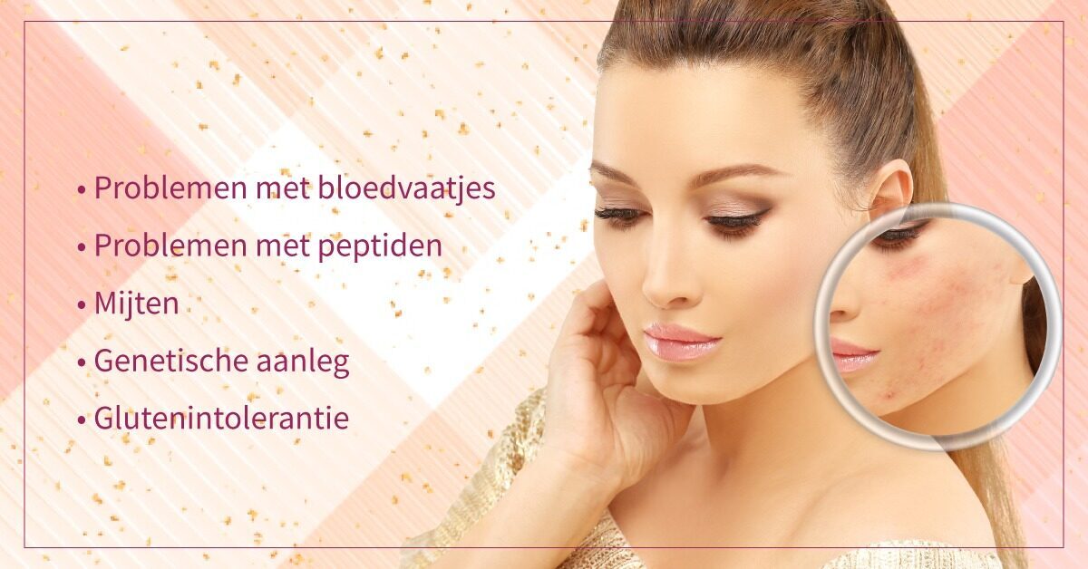 blonde vrouw rosacea raakt gezicht aan