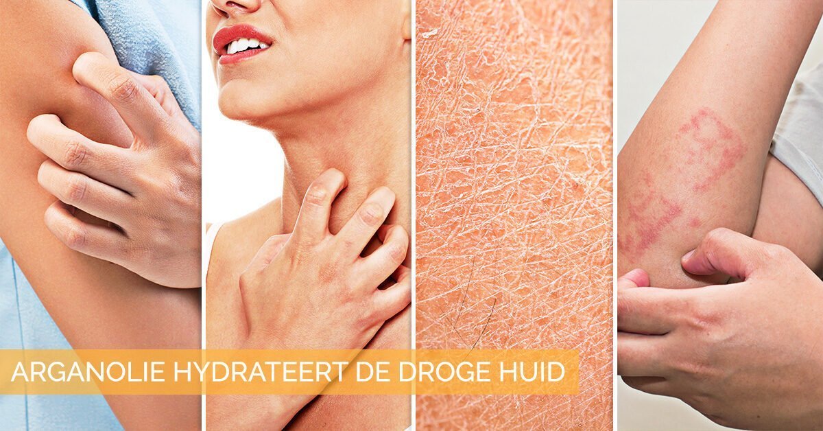 droge huid
