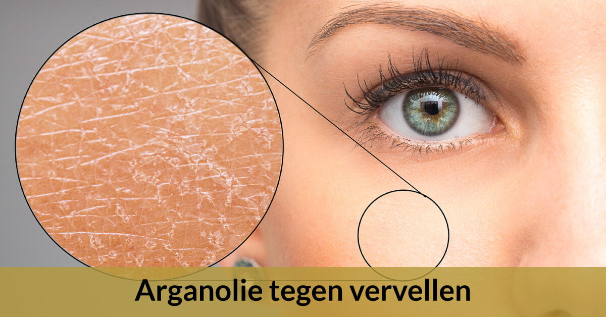 behandeling gezicht vervellen schilfers