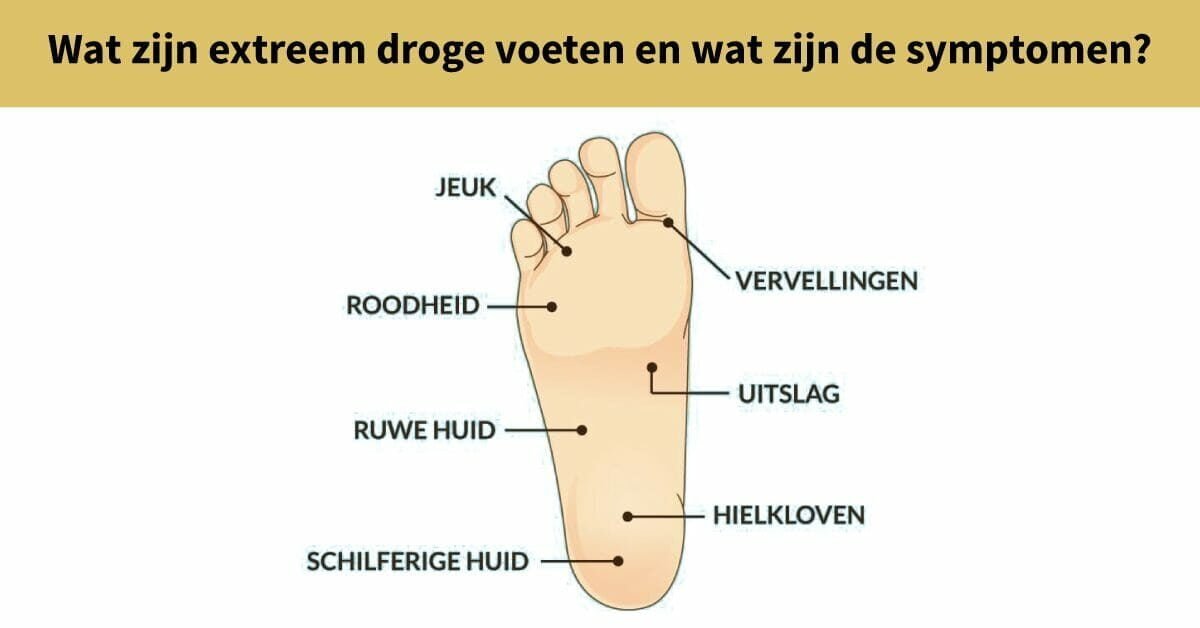 illustratie voet