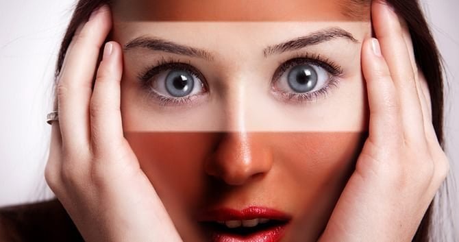 leer-hier-hoe-je-een-zonverbrande-huid-kunt-behandelen2