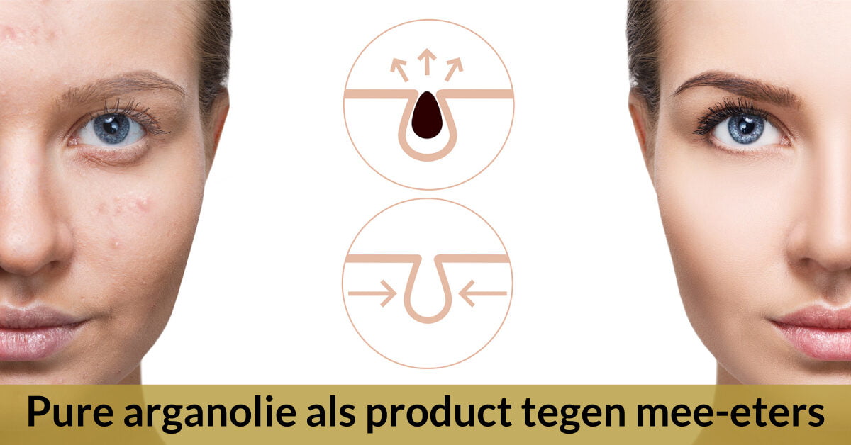 mee eters behandelen met pure arganolie hoe voor en na