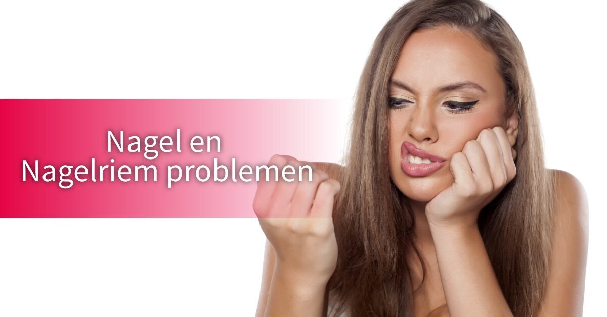 nagel nagelriem problemen vrouw boos nagels