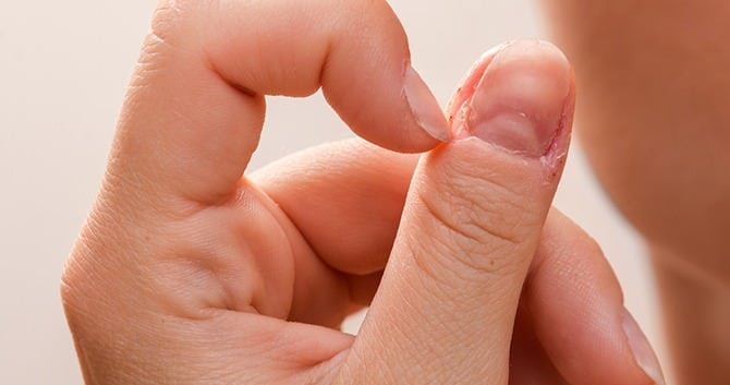 voorkom-losse-velletjes-en-mogelijk-vervelende-infecties3