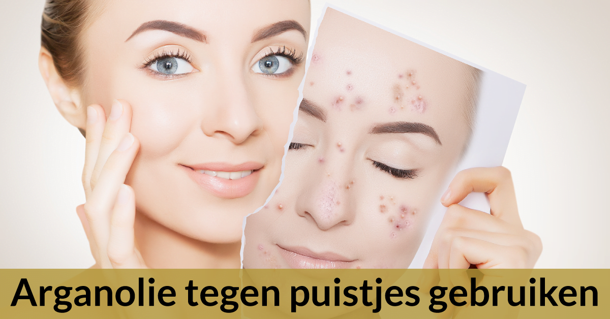 verzorgde vrouw gezonde huid huid met puistjes behandelen arganolie