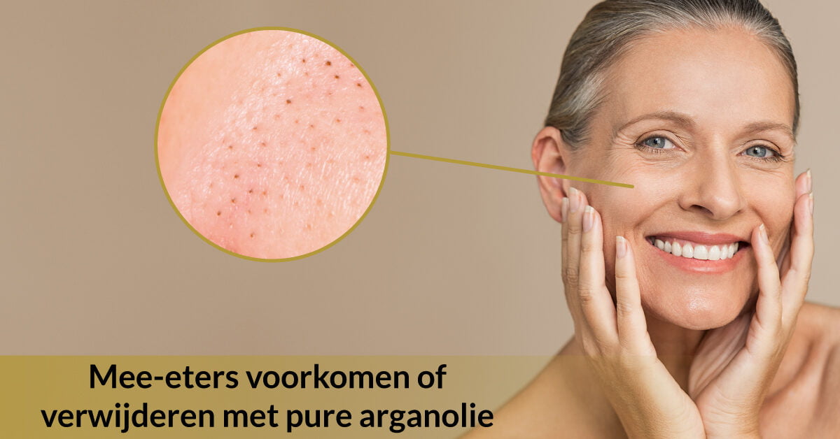 vrouw mee-eters uitvergroot behandelen verwijderen mee eters pure arganolie