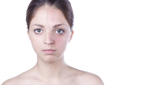 werkt-arganolie-voor-vette-huidtypes1