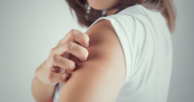 zelf-thuis-je-eczeem-behandelen1